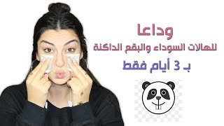 خلطة طبيعية للهالات السوداء والبقع الداكنة بـ 3 أيام فقط - Natural Remedy for dark circles