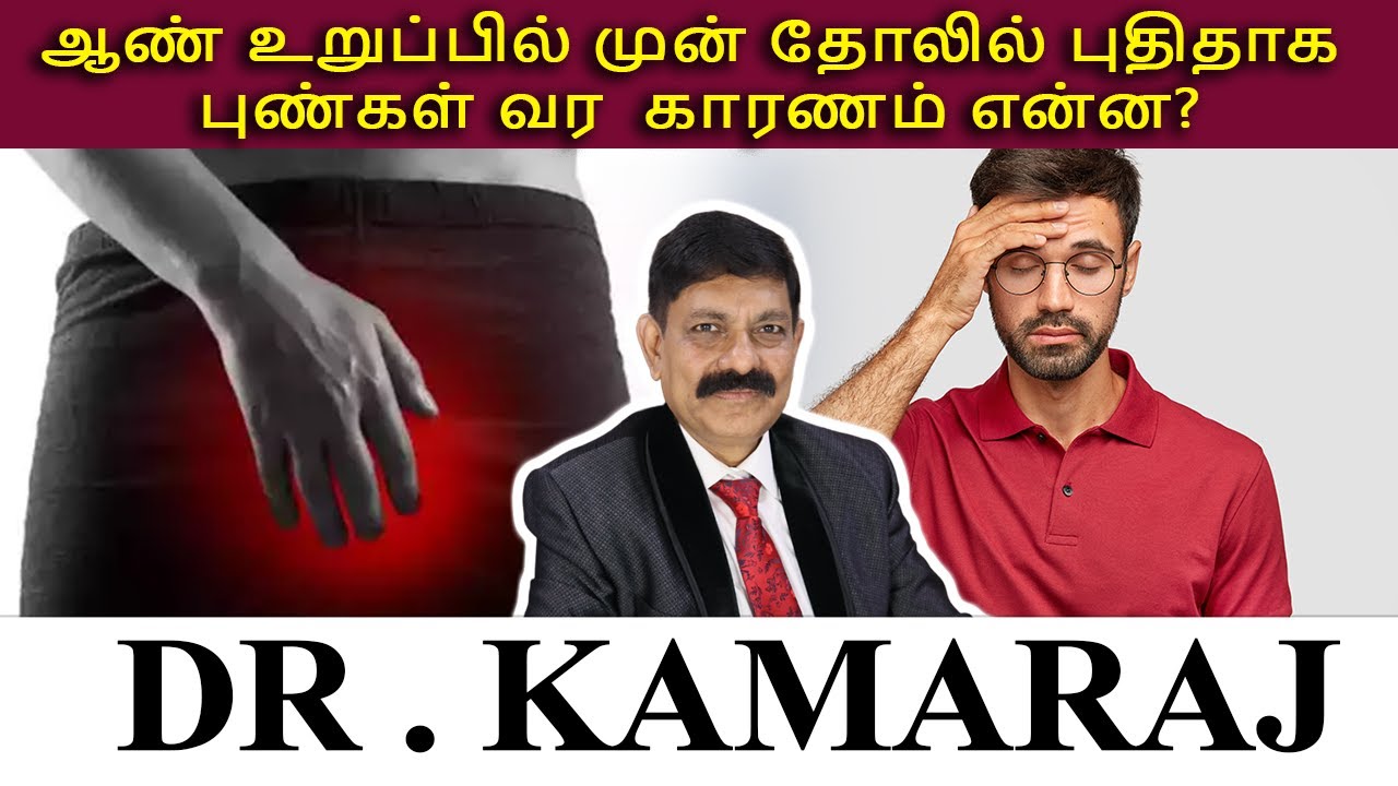 ஆண் உறுப்பில் முன் தோலில் புதிதாக  புண்கள் வர காரணம் என்ன ?