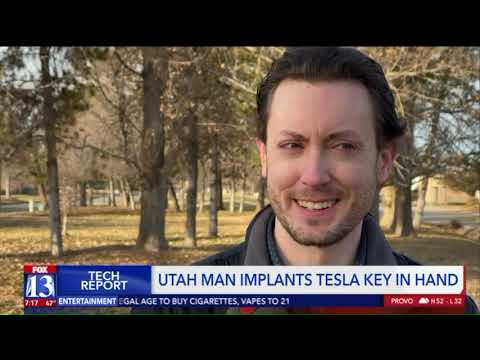 UT man implants Tesla key and other chips in hands