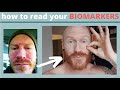 How To Read your BIOMARKERS: the Key to customizing your DIET and HEALING your Skin