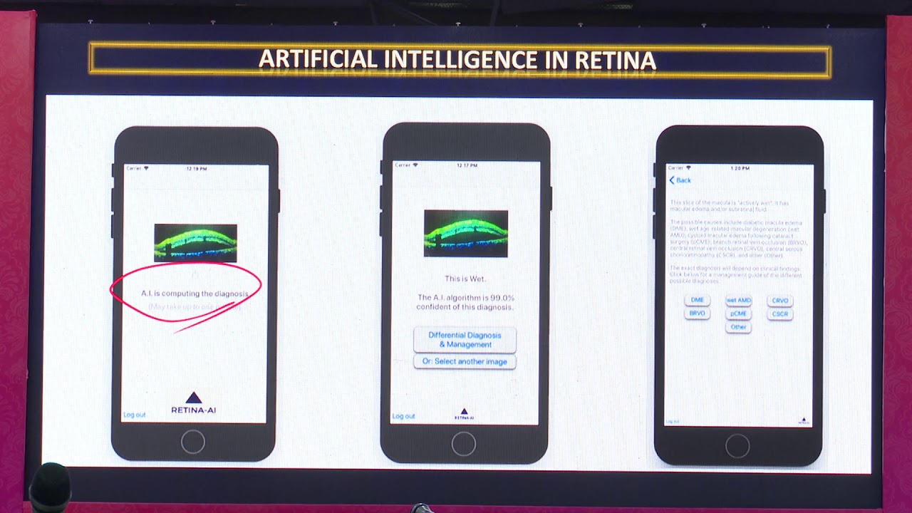 AIOC2020 GP164 T8 Dr  Shrinivas Joshi AI in Retina Diagnostics