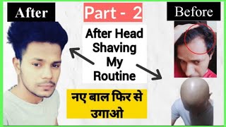 After Head Shaving Full Routine for fast  Hair Growth & Receding Hairline,New Hair || Dhru Rao