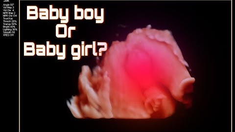 Baby boy or baby girl?