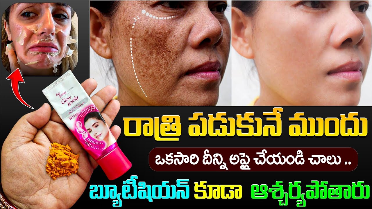 రాత్రి పడుకునే ముందు దీన్ని అప్లై చేయండి చాలు బ్యూటీషియన్ కూడా ఆశ్చర్యపోతారు | Tan Removal Remedy