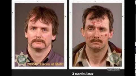 Faces of Meth - shocking before & after pictures