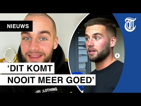 Donny eerlijk over afgeslepen tanden: ‘Goedkope facings’