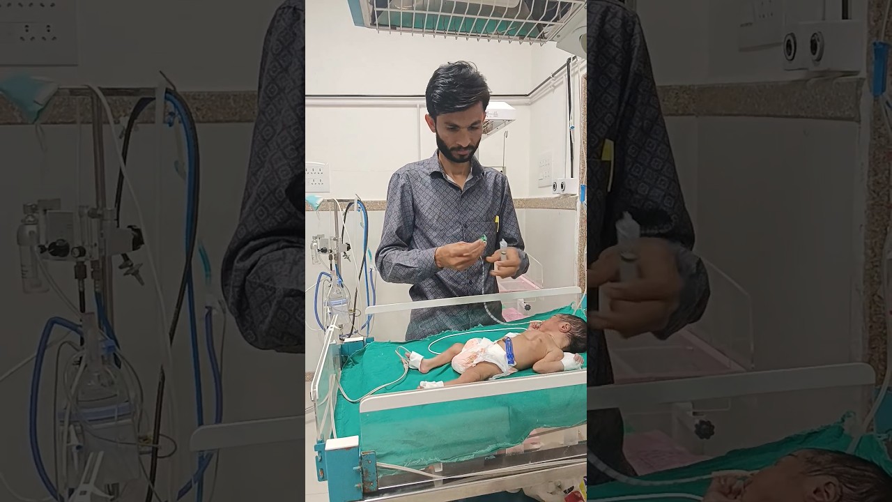 How can a premature baby be NG feed in NICU 