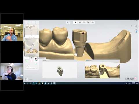 Digital Dentistry Training Series: Scan and Design Abutments
