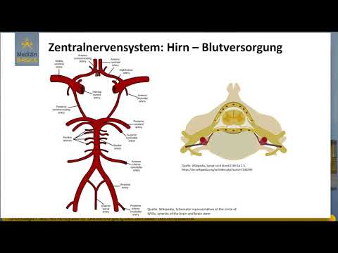 Video: Gefäßstenose Von Gehirn, Hals Und Herz