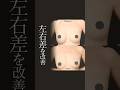 【左右差を改善】シリコンバッグ除去+脂肪注入豊胸でバストの左右差をなくす