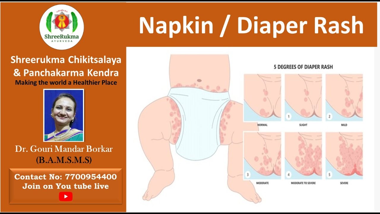 Napkin Rash Napkin / Diaper Rash - YouTube