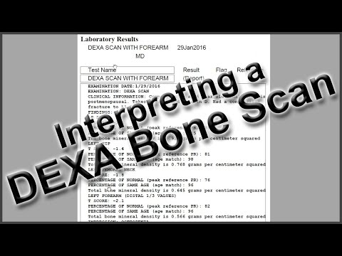 Interpreting a DEXA Bone Scan