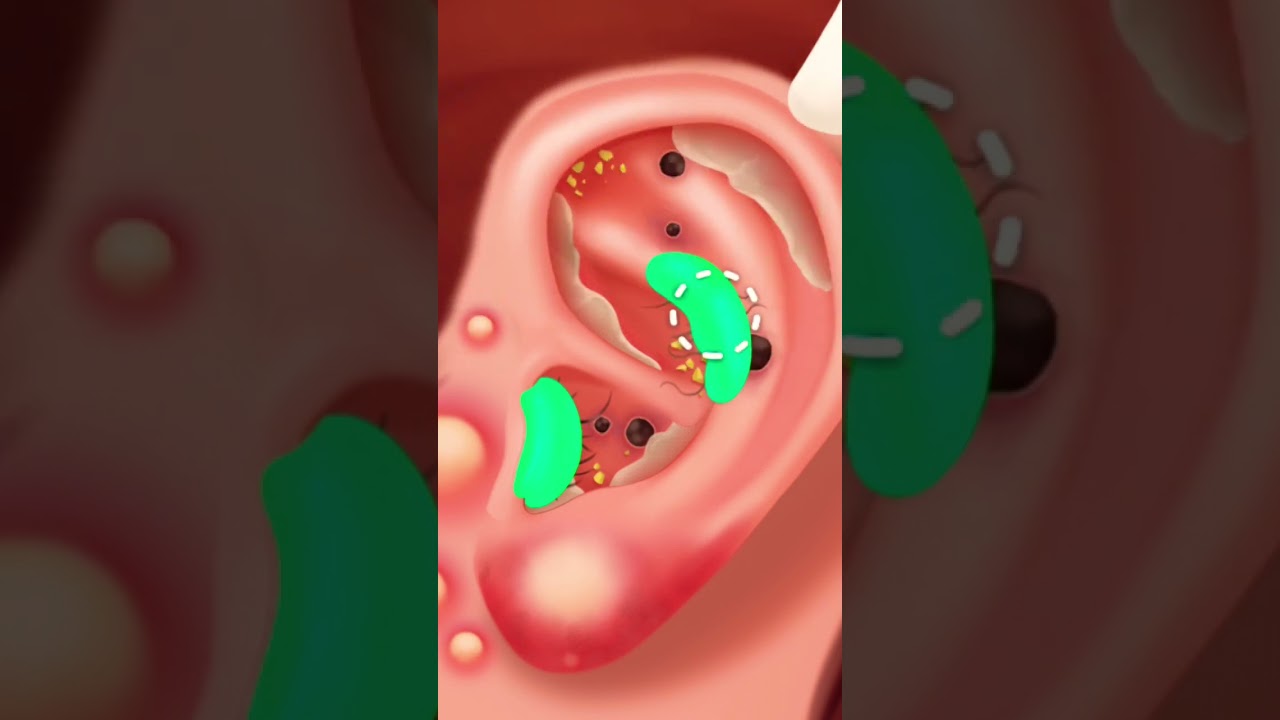 Game Happy Hospital Ear Time first stage 
