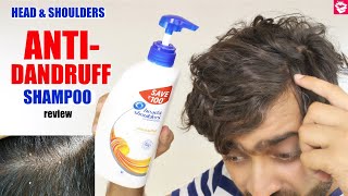 Head & Shoulders ANTI- DANDRUFF Shampoo review | Side Effects, Benefits, Effect | QualityMantra