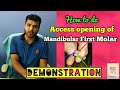 Mandibular molar Access opening in hindi ( English Subtitle)