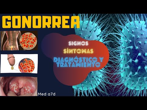 Gonorrea Signos y Síntomas Diagnóstico Tratamiento ETS