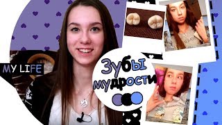 ЗУБЫ МУДРОСТИ | Советы и личный опыт