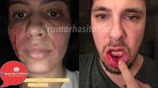 90 Day Fiance Stars Colt and Larissa Get into a BLOODY FIGHT, 90 Day Fiance Stars Colt and Larissa Get into a BLOODY FIGHT,