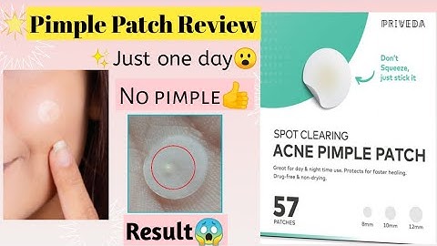 priveda acne pimple patch review in tamil✨|spot clearing patch|no pimples