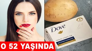 52 Yaşında Ama Bu Kremi Kullandığı İçin 20 Yaşında Kadına Benziyor !!│Güzellik Bakım Resimi