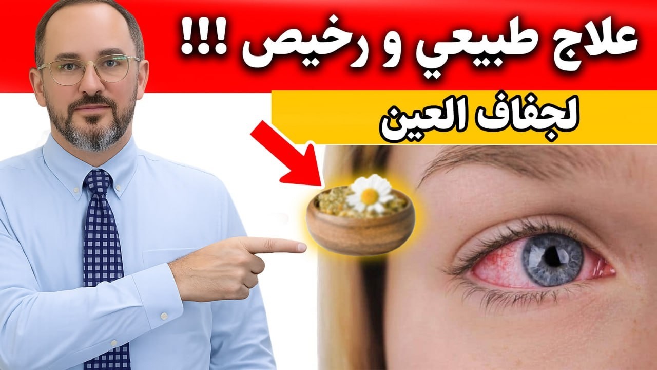 علاج جفاف العين طبيعيًا: 7 طرق بسيطة (بدون قطرات)