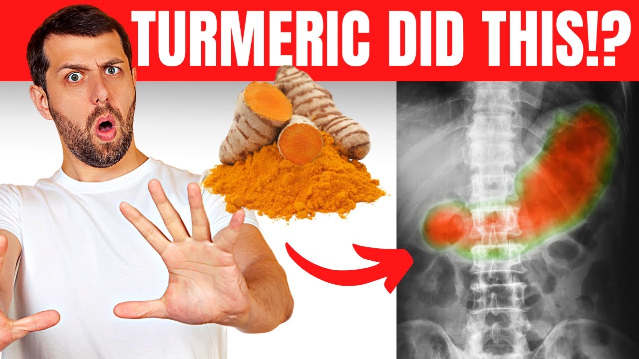 Negative Effects Of TOO MUCH Turmeric 🚨😲 YouTube