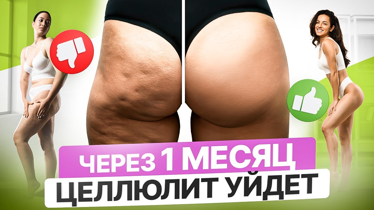 Как убрать дряблость, целлюлит, отеки и разогнать лимфу за 30 ДНЕЙ? Способ, который 100% РАБОТАЕТ