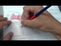 Removable partial denture  reviewing design and how to draw