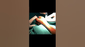 कैसे होती है एंजियोग्राफी? How Angiography is Done Step by Step