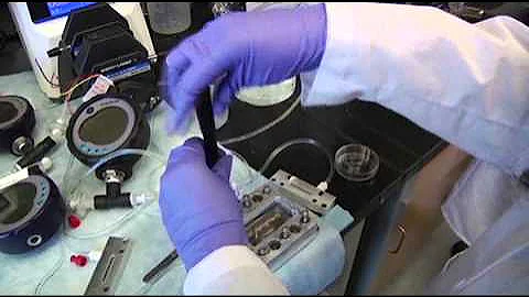 Dialysis Patients Hopeful for Artificial Kidney