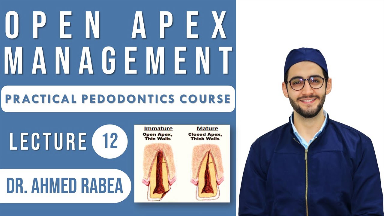Lecture 12: Open Apex Management  | كورس بيدو عملي