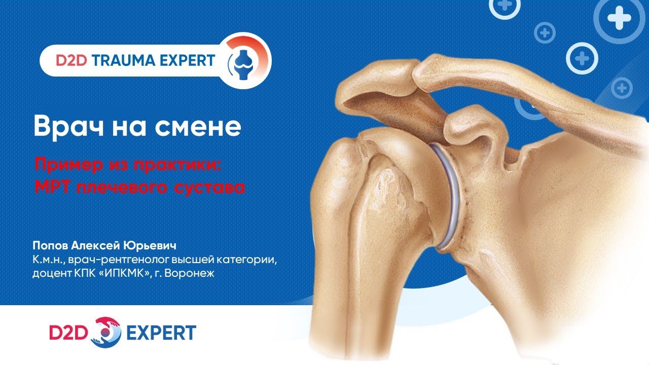 Врач на смене: пример из практики - МРТ плечевого сустава - YouTube