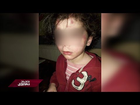 #ახალიკვირა დაუცველი სიცოცხლე