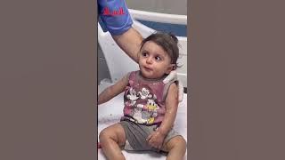 Injured cute baby girl palestine 🇵🇸😭