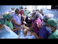Saving a baby   very difficult anesthesia  part 2