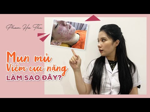 ĐIỀU TRỊ MỤN VIÊM-MỤN MỦ CHUẨN Y KHOA| MỤN VIÊM NẶNG CÓ MỦ ĐIỀU TRỊ THẾ NÀO| PHẠM HÀ THU