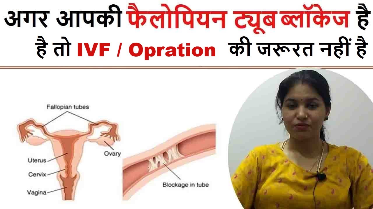 Fallopian Tube Blockage Treatment Without Surgery Aasha Ayurveda fallopian-tube-blockage-treatment-without-surgery-aasha-ayurveda