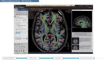 Philips IntelliSpace Portal  clinical application MR Neurology