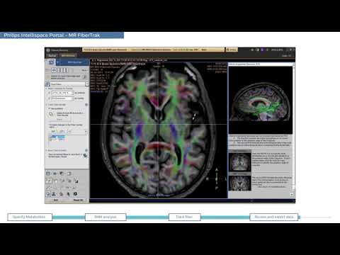Philips IntelliSpace Portal  clinical application MR Neurology