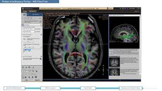 Philips IntelliSpace Portal  clinical application MR Neurology screenshot 5