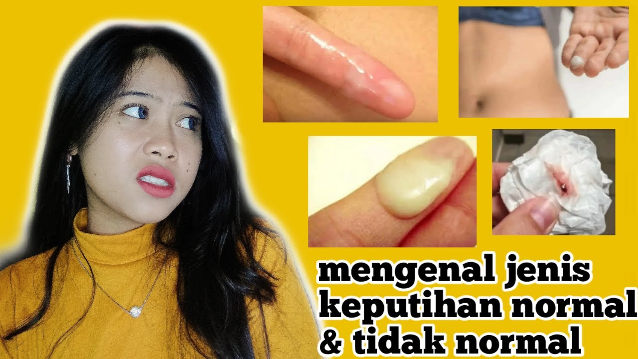 Mengenal Keputihan Normal Dan Tidak Normal Youtube