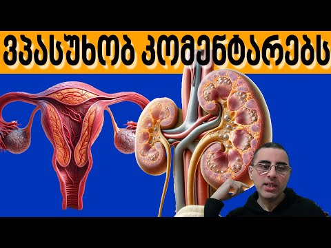 ვპასუხობ კომენტარებს: ჯანსაღ ცხოვრება გარანტიაა რომ ცუდი დაავადება არ შემხცდება?