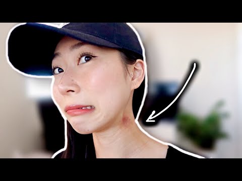 HICKEY PRANK ON MY BOYFRIEND