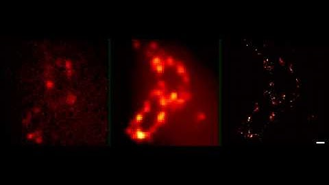 Time-Lapse: PALM Acquisition of Golgi Apparatus by Dr. Eric Betzig