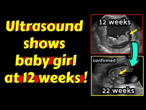 वीडियो: कैसे बताएं कि कोई गर्भवती है: 12 कदम (चित्रों के साथ)