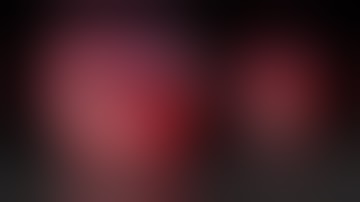 Subxiphoid Right Upper Lobectomy