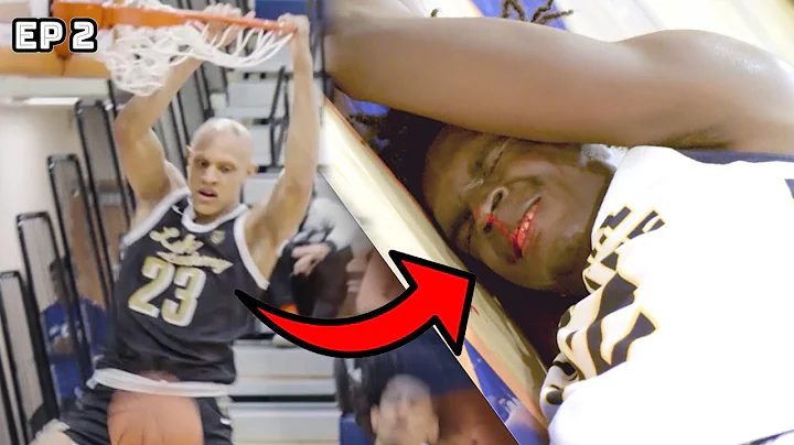 HE BROKE HIS FACE!? #1 TEAM IN COUNTRY GETS CHALLE...