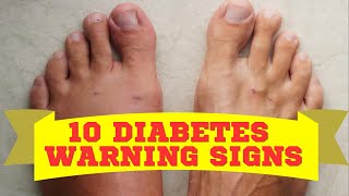 Do I Have Diabetes?! (10 Warning Signs & What To Do About It!)