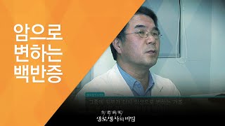 Leukoplakia Turning Into Cancer - (03/02/2013 Episode 450) Losing the Joy of Eating and Speaking ...