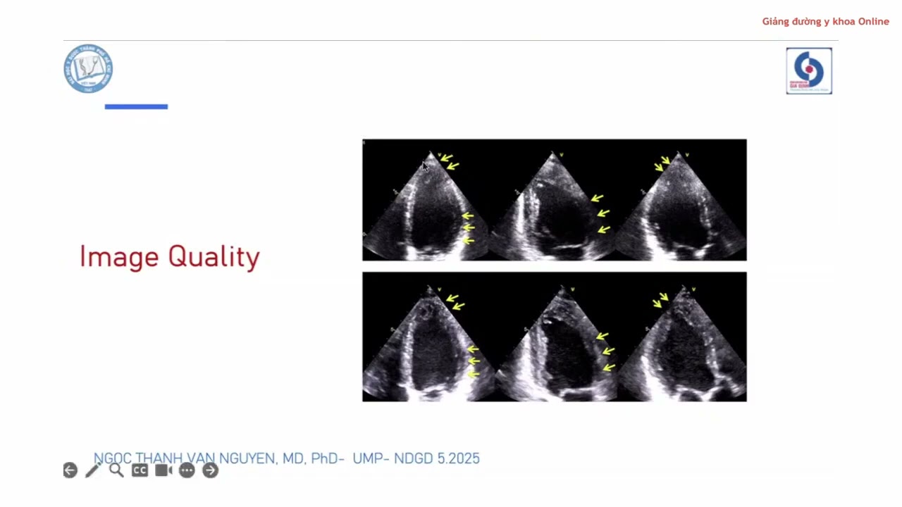 2025 và Suy tim | Những câu hỏi thường gặp | TS. Nguyễn Ngọc Thanh Vân